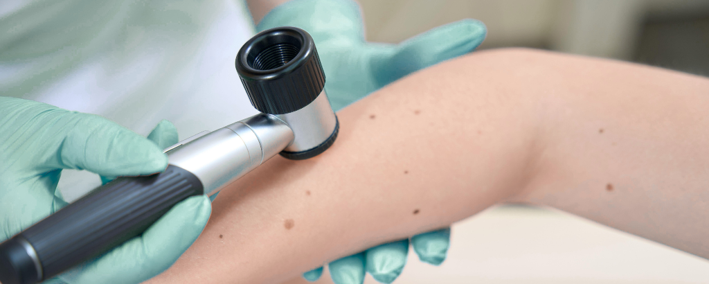 Dermatochirurgie in München bei Dr. Westhoff